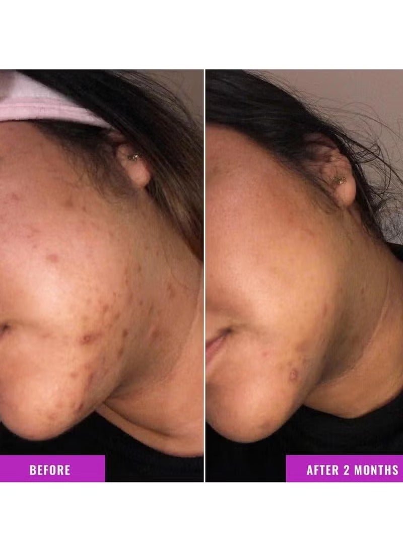 Good Molecules Discoloration Correcting Serum - Image 4