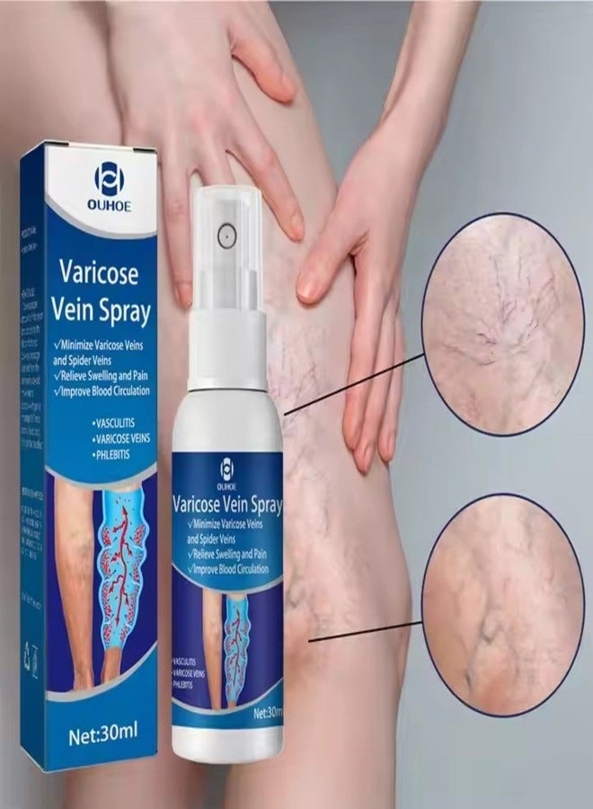 OUHOE OUHOE 30ml Varicose Vein Spray Safe Non-toxic Relieve Swelling Pain Improve Blood Circulation Tighten Skin Relax Muscles  - Image 1