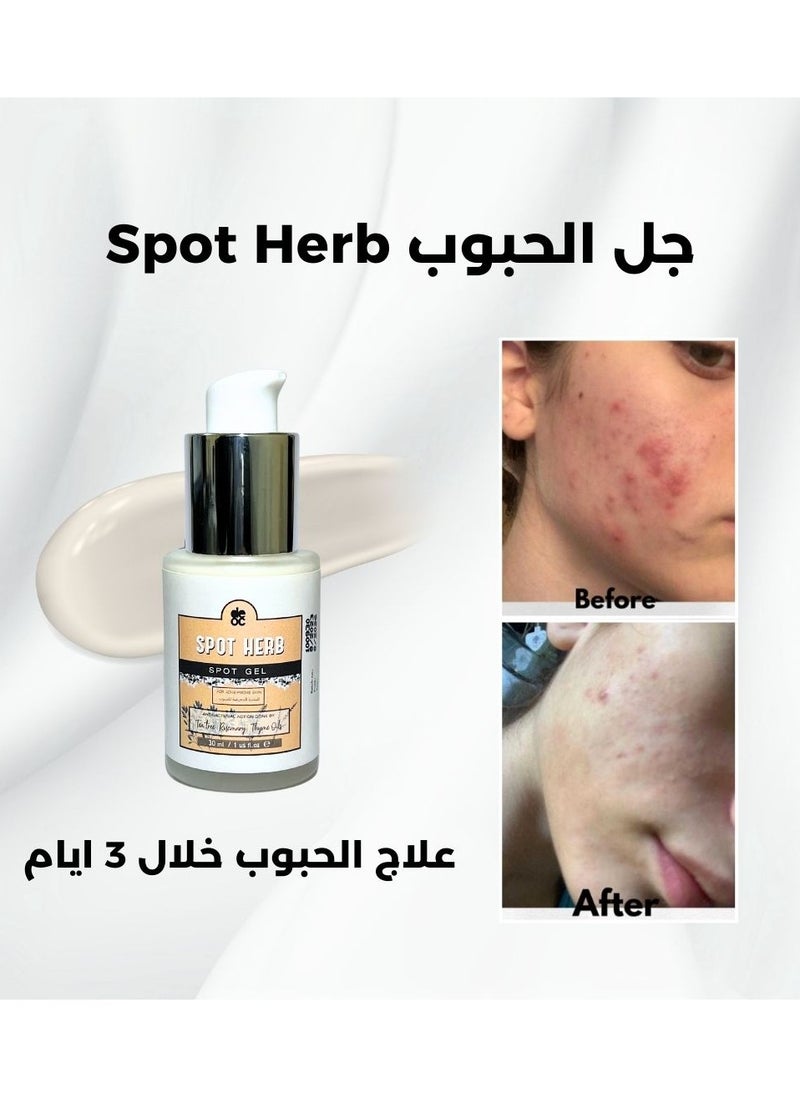 لعلاج الحبوب Spot herb - pzsku/ZD5A59C71CF229B2CF66DZ/45/_/1711029447/89354a90-ff29-4588-827d-1771ce963d1b