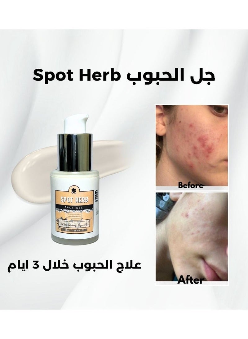 ديوك سبوت هيرب جيل - Image 4