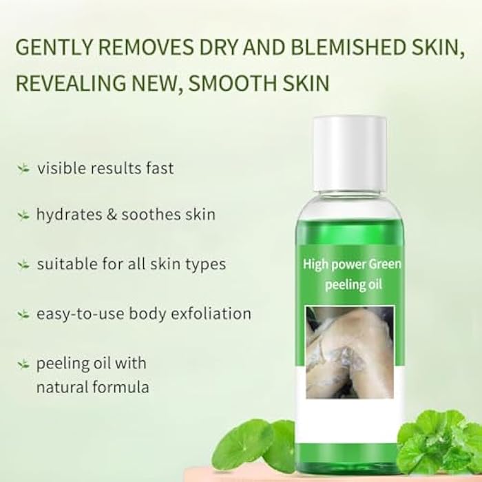 IREV Peeling Oil for Dark Skin, Green Peeling Oil, Facial Peels with Hyaluronate,Exfoliating Peel Solution for Body, Chemical Peel At Home for Dark Spots, Body Exfoliant Peels 3.66 OZ - Image 4