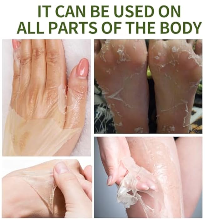 IREV Peeling Oil for Dark Skin, Green Peeling Oil, Facial Peels with Hyaluronate,Exfoliating Peel Solution for Body, Chemical Peel At Home for Dark Spots, Body Exfoliant Peels 3.66 OZ - Image 2