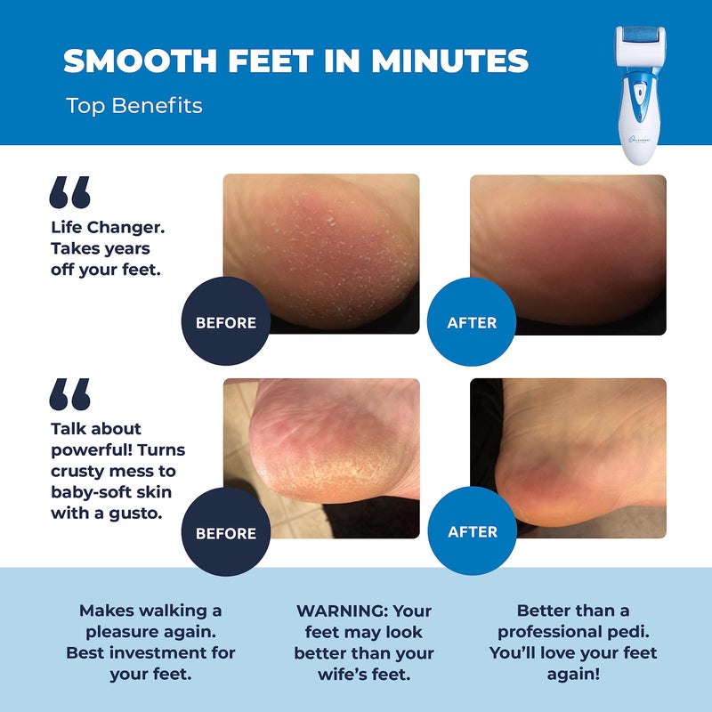 Own Harmony Electric Callus Remover: Own Harmony Professional Pedicure Tools Foot Care For Women  Rechargeable Foot Scrubber  Cr900 Electronic Feet File Pedi Sander Best For Hard Cracked Dry Dead Skin  3 Rollers - Image 2
