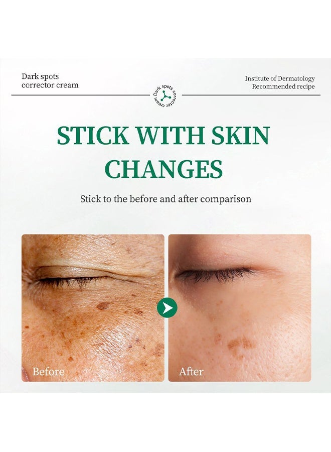 LANEMAY Multiple Efficacy-Daek Spot Corrector Cream - Dark Spot Remover for Face Dark Spot Corrector Cream Sun Spot Melasma Freckle Age spot Removal for Women and Men Improves Hyperpigmentation - Image 5