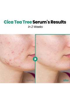 Glam Up GLAM UP Clear Soothing Cica Tea Tree Serum  - Image 5