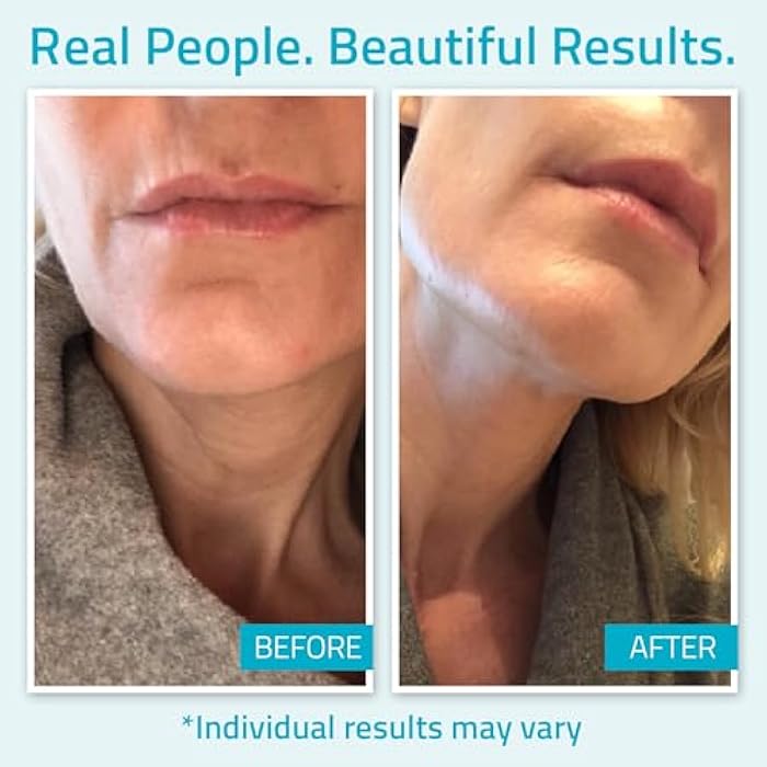 YEOUTH Day Night Face Moisturizer with Hyaluronic Acid, Snail Mucin Cream and Copper Tripeptide, Hydrating Fragrance Free Facial Moisturizer, Face Skin Care Cream for Women and Men 4oz - Image 4