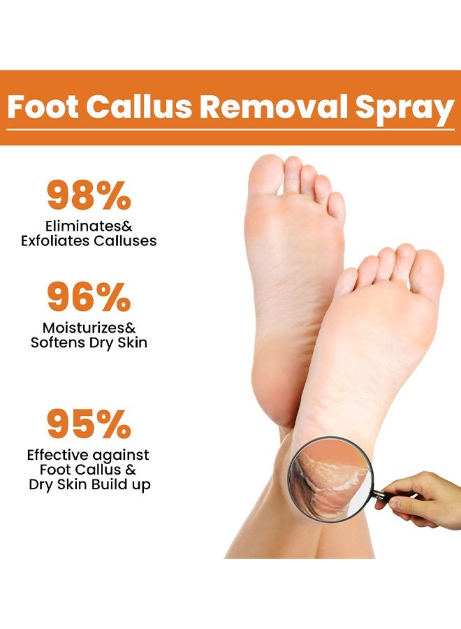 SOUTH MOON Foot Callus Removal Spray - Foot Spray Cleans Dead Skin Cuticles Calluses Prevents Dryness Repairs Rough Skin and Moisturizes Care Spray - Image 5