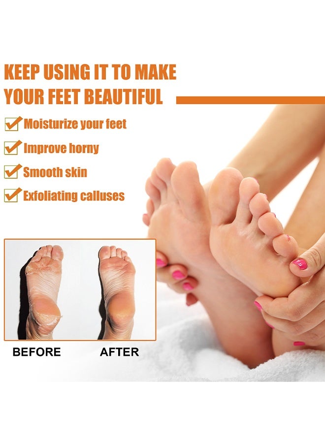SOUTH MOON Foot Callus Removal Spray - Foot Spray Cleans Dead Skin Cuticles Calluses Prevents Dryness Repairs Rough Skin and Moisturizes Care Spray - Image 2