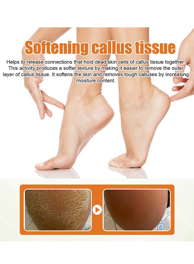 SOUTH MOON Foot Callus Removal Spray - Foot Spray Cleans Dead Skin Cuticles Calluses Prevents Dryness Repairs Rough Skin and Moisturizes Care Spray - Image 4