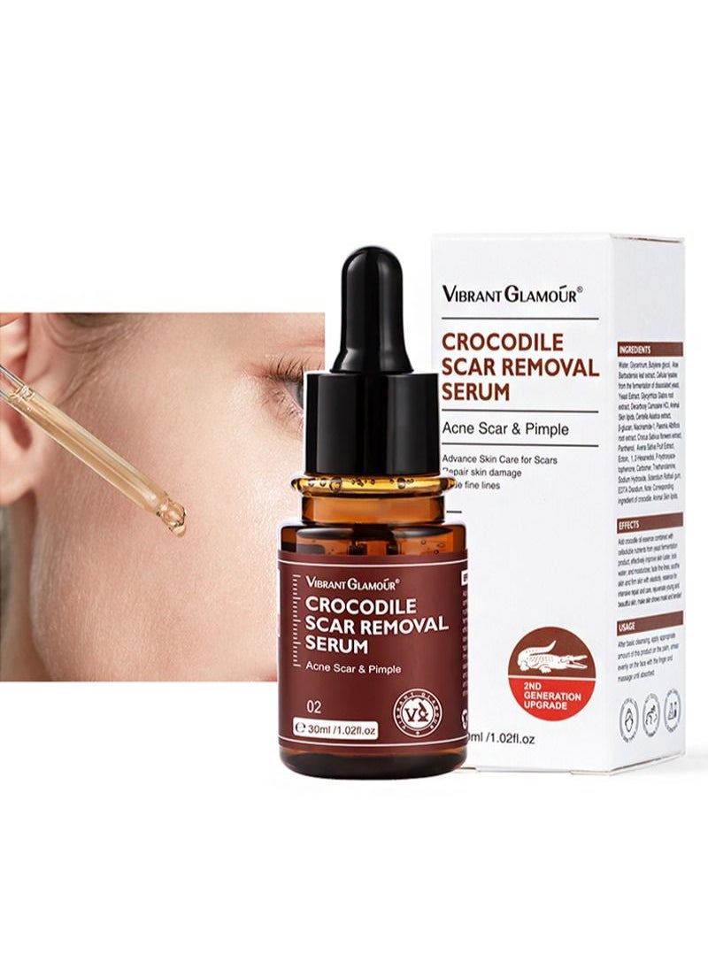 Vibrant Glamour - Crocodile Scar Removal Serum Crocodile Scar Removal Serum  Pigmented Acne Treatment Stretch Mark Removal (30ml) - Image 1