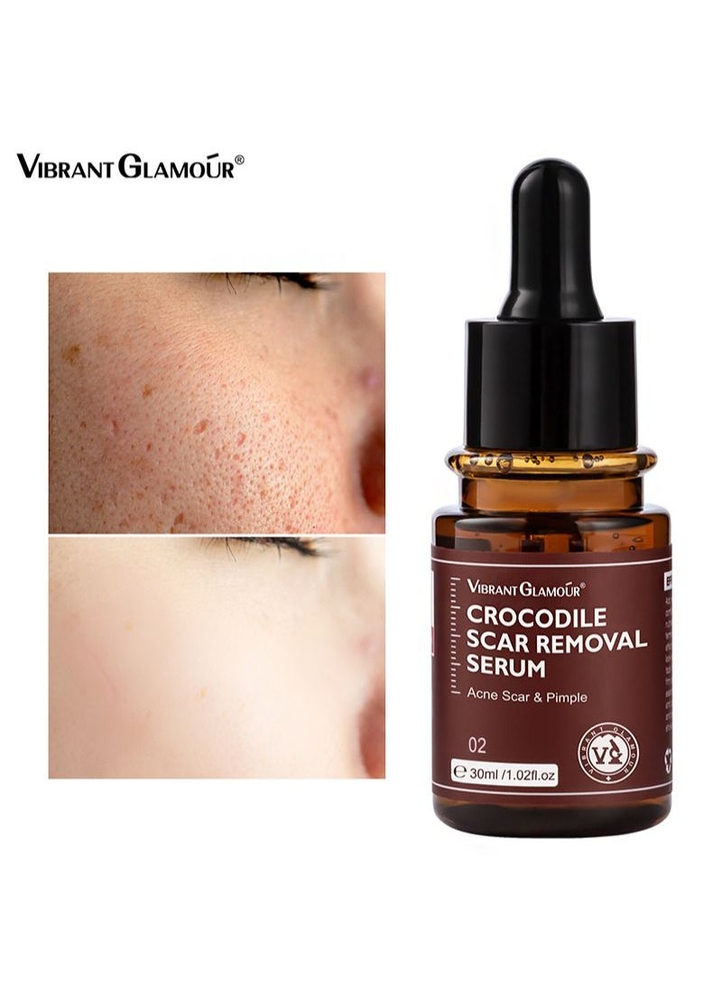 Vibrant Glamour - Crocodile Scar Removal Serum Crocodile Scar Removal Serum  Pigmented Acne Treatment Stretch Mark Removal (30ml) - Image 1