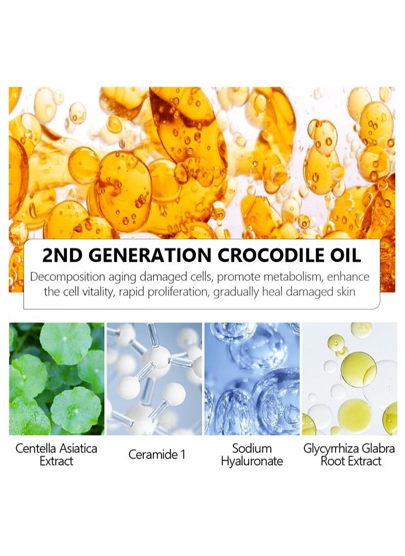 Vibrant Glamour - Crocodile Scar Removal Serum Crocodile Scar Removal Serum  Pigmented Acne Treatment Stretch Mark Removal (30ml) - Image 1