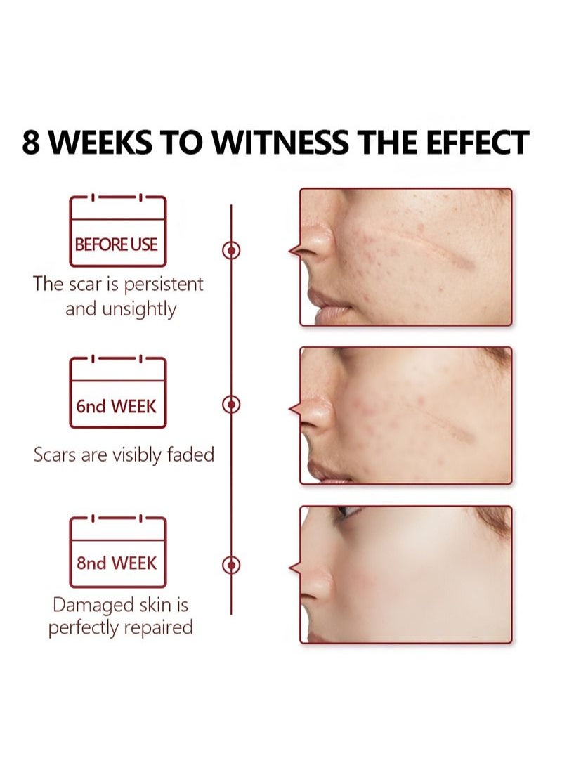 Vibrant Glamour - Crocodile Scar Removal Serum Crocodile Scar Removal Serum  Pigmented Acne Treatment Stretch Mark Removal (30ml) - Image 1