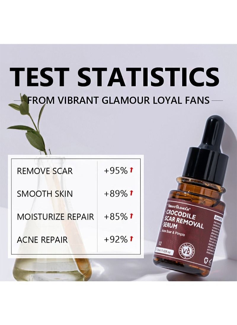 Vibrant Glamour - Crocodile Scar Removal Serum Crocodile Scar Removal Serum  Pigmented Acne Treatment Stretch Mark Removal (30ml) - Image 1