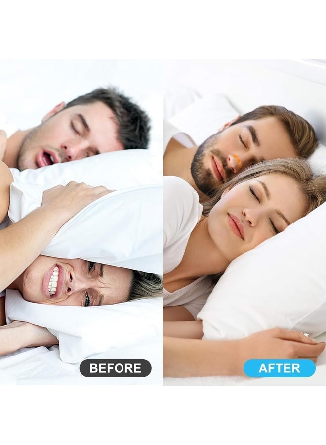 Breathing Nose Strip Starter Set with adjustable magnets, sweat-resistant and skin-safe nose strips, supports smoother breathing, improves sleep quality, Adult Breathing Support Set (30pcs) - Image 3