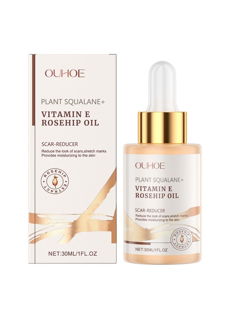 OUHOE Hydrating Squalane Rosehip Oil  - Fights Scars, Wrinkles, Anti-Aging Glow - Image 1