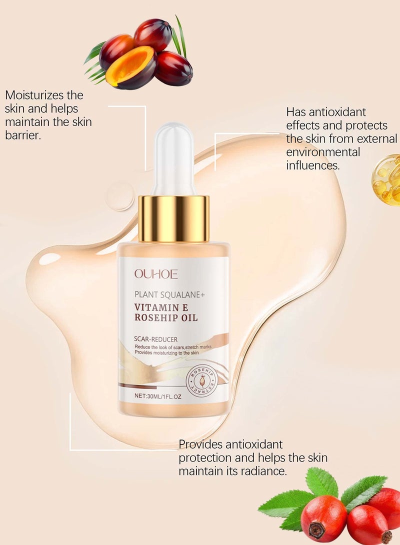 OUHOE Hydrating Squalane Rosehip Oil  - Fights Scars, Wrinkles, Anti-Aging Glow - Image 2