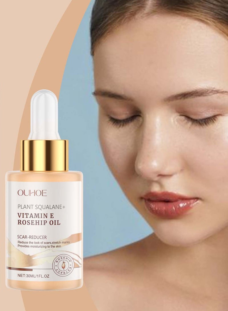 OUHOE Hydrating Squalane Rosehip Oil  - Fights Scars, Wrinkles, Anti-Aging Glow - Image 3