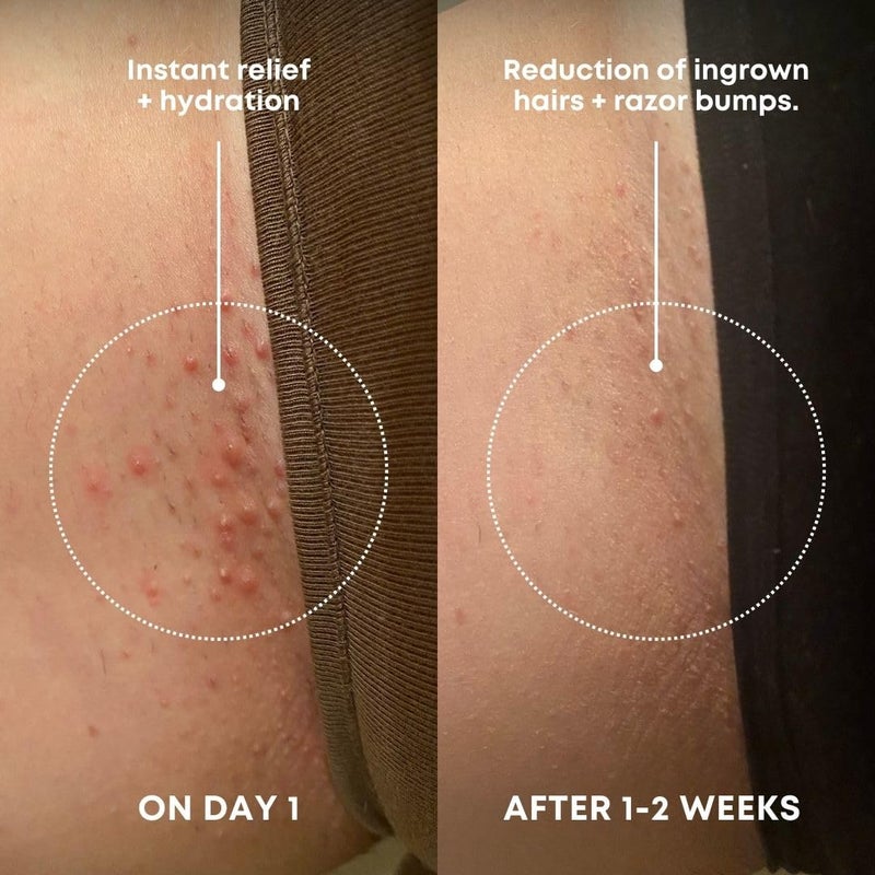 Bushbalm Ingrown Hair Exfoliating Scrub â€“ Pre-Shave Sugar Scrub for Ingrown Hairs, Razor Bumps & Dry Skin â€“ Gently Buffs & Soothes Sensitive Skin â€“ Nude, 236ml - Image 2