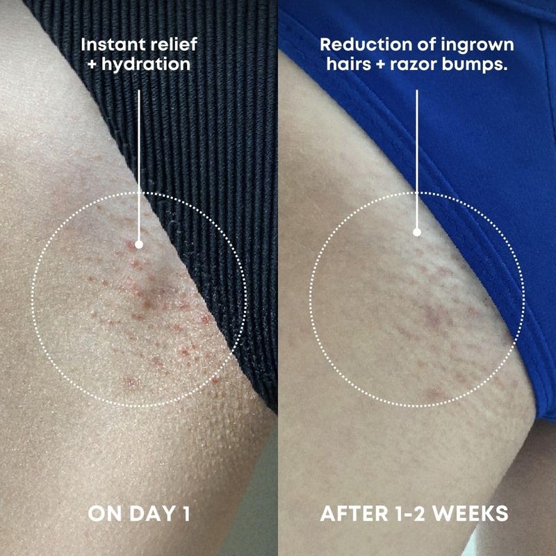 Bushbalm Ingrown Hair Exfoliating Scrub â€“ Pre-Shave Sugar Scrub for Ingrown Hairs, Razor Bumps & Dry Skin â€“ Gently Buffs & Soothes Sensitive Skin â€“ Nude, 236ml - Image 3