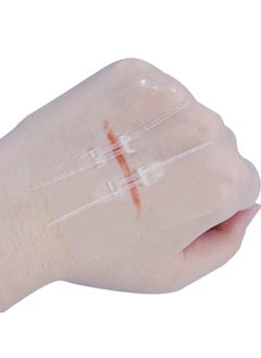 HONS Butterfly Bandaids for Wound Closure 2 Pcs zip stitch wound closure strips Surgical Laceration Repair without Sew Quick Clot Emergency Wound Closures Device  - Image 1