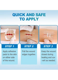 HONS Butterfly Bandaids for Wound Closure 2 Pcs zip stitch wound closure strips Surgical Laceration Repair without Sew Quick Clot Emergency Wound Closures Device  - Image 3