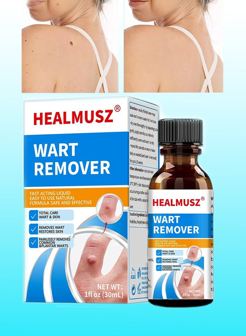HEALMUSZ Wart Remover Liquid Herbal Ingredients Safe Body Warts Treatment for Acne Moles Scar Wart Treatment Wart Remover Oil for Face Body Wart Remover Gel 30ml - Image 1