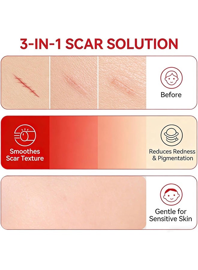 LANISKA Scar Soothing Cream ，Smoothing Cream for Scars - Gentle Care for Sensitive Skin, Helps Improve Appearance of Scars, Reduces Redness, Lightweight Non-Greasy Formula 30g - Image 2
