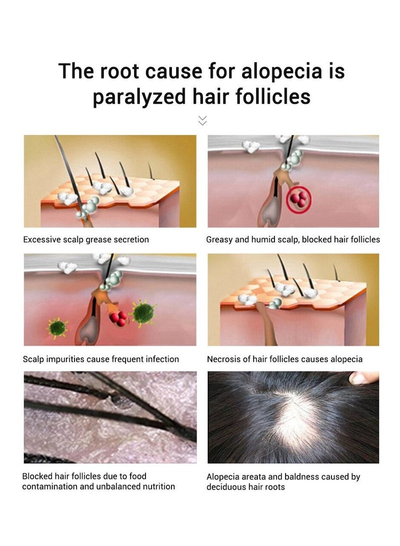 PURC Hair Growth Essence Oil For Hair Fall Hair Regrowth & Scalp Treatment Ginger Essential Oil Supports Healthy Hair Thinning Treatment Hair Growth Oil for Women & Men 20ml - Image 2