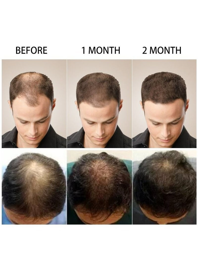 PURC Hair Growth Essence Oil For Hair Fall Hair Regrowth & Scalp Treatment Ginger Essential Oil Supports Healthy Hair Thinning Treatment Hair Growth Oil for Women & Men 20ml - Image 4