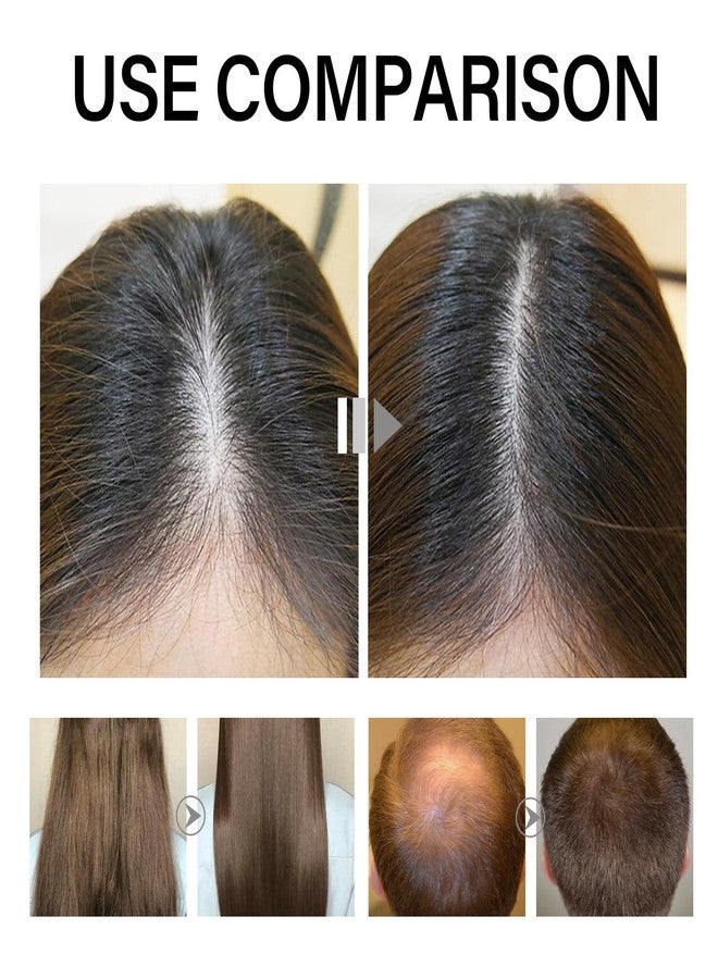 KUNLEN Sugar Gel Deoxyribose Hair Growth Serum - Image 3