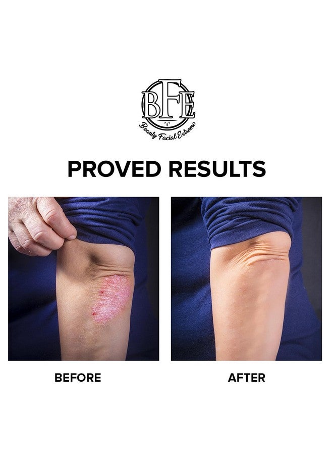 بيوتي فيشال إكستريم لوشن تقشير الجسم بالتقرن الشعري 12% حمض اللاكتيك. يوفر رطوبة فورية وتقشيرًا لطيفًا لعلاج الأعراض المرتبطة بالتقرن الشعري وحالات الجلد الجاف المتعرج. - Image 3