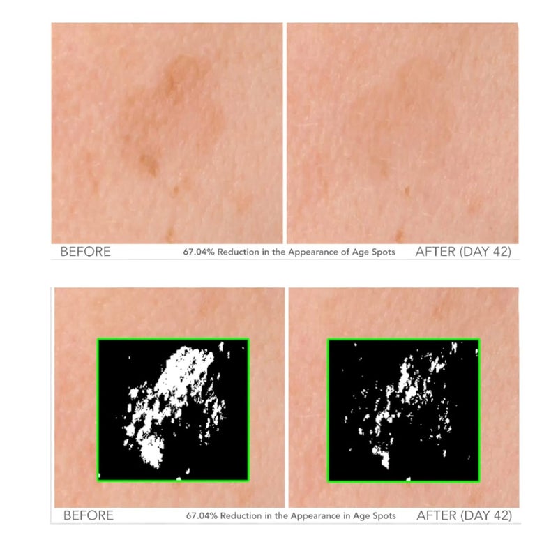 Serious Skincare Beyond Intensive Vitamin C Serum for Face 60 Day Facial Treatment for Healthy Glowing Skin and Brightening Smoothes Lines Pores and Fades Dark Spots 2 Piece AntiAging Set - Image 3