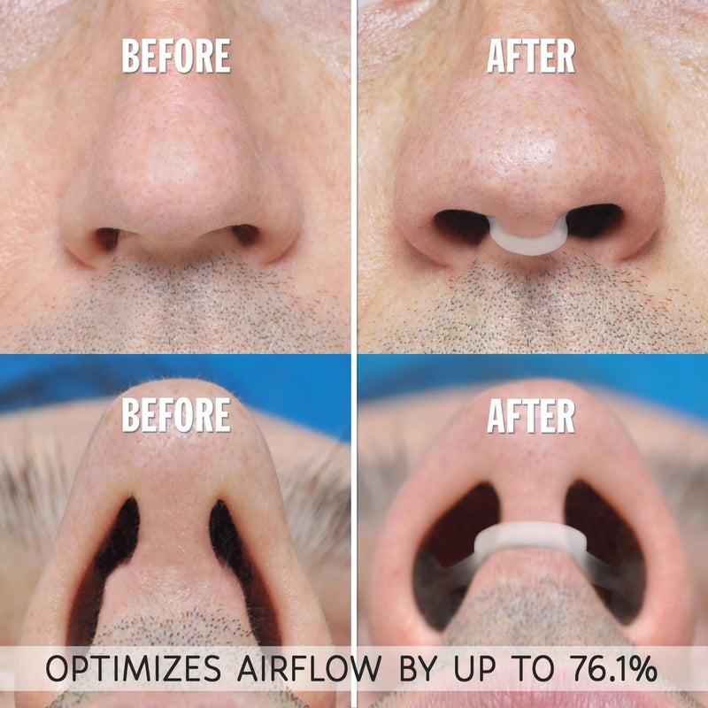 airmax ديلتور الأنف AIRMAX لتحسين النوم - جهاز طبيعي ومريح مضاد للشخير، حل للشخير لزيادة تدفق الهواء وسهولة التنفس (متوسط - شفاف) - Image 4