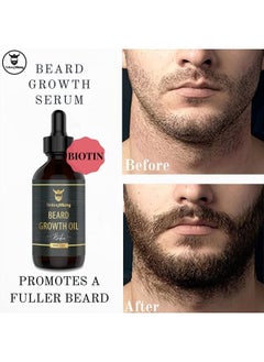 Striking Viking Beard Growth Oil with Biotin – Thickening and Conditioning Beard Oil - All Natural Beard Growth Serum Promotes Facial Hair Growth for Men, Sandalwood  - Image 2