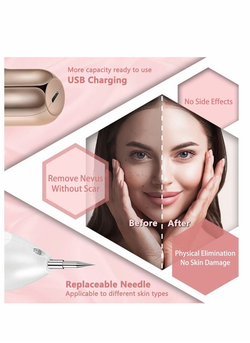 KASTWAVE - Skin Tag Remover, KASTWAVE Skin Tag Removal Kit Tools with Home Usage USB Charging/30 Replaceable Device to Remove Skin Tags- Gold - Image 1