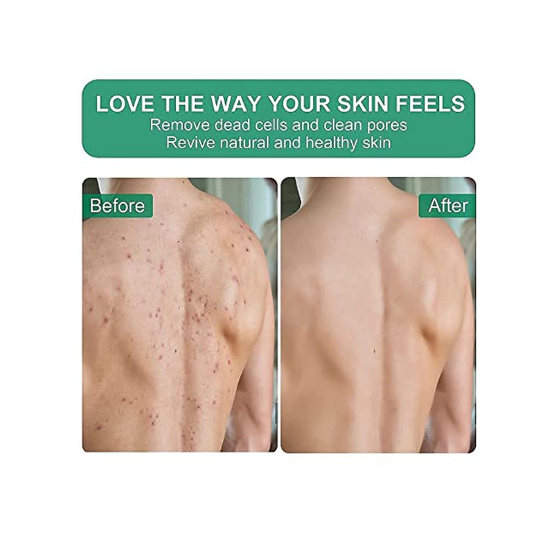 Zikra Exfoliating Gloves 2 Pcs, for Bath Shower Exfoliation Mitt, Body Scrubber, Dead Skin Remover Mitt for Women Men - Image 2