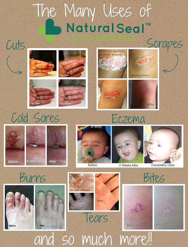 KeriCures Natural Seal Spray on Bandage with Itch Relief 1oz First Aid Barrier Soothing Protective Moisturizing Liquid Bandage for Kids Woman Owned Small Business - Image 5
