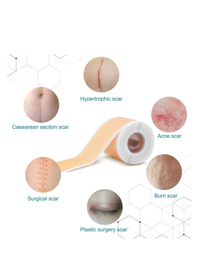 Elaimei Medical Silicone Scar Sheets Roll 1.5m - Silicone Gel Sheets for Scar Removal, Silicone Sheets For Removing Scars Painlessly, Reusable Scar Gel Treatment,Cut Custom Size Strips - Image 4