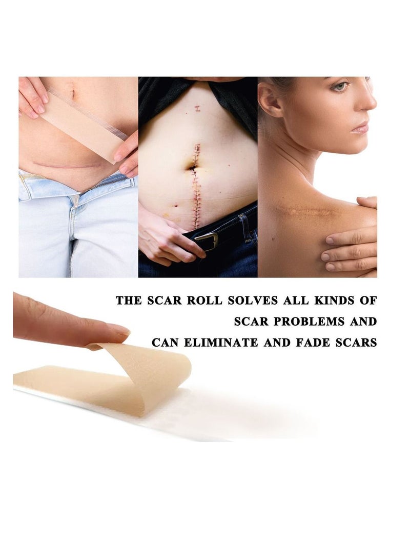 Elaimei Medical Silicone Scar Sheets Roll 1.5m - Silicone Gel Sheets for Scar Removal, Silicone Sheets For Removing Scars Painlessly, Reusable Scar Gel Treatment,Cut Custom Size Strips - Image 5