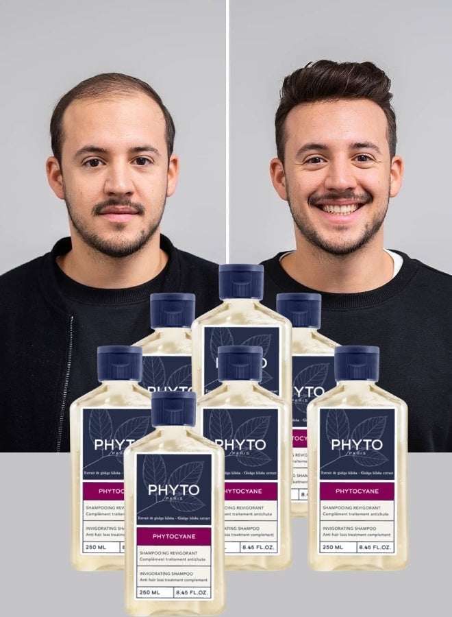 فيتو 7 قطع شامبو فيتو باريس لعلاج تساقط الشعر للنساء و الرجال منشط 250مل - Image 1