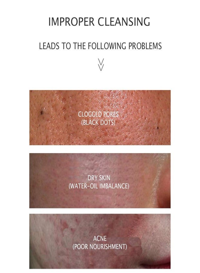 JOMTAM Amino Acid Cleansing Facial Anti-Acne Essence Moisturizing Natural Ingredients Water-Oil Balance 100G - Image 2
