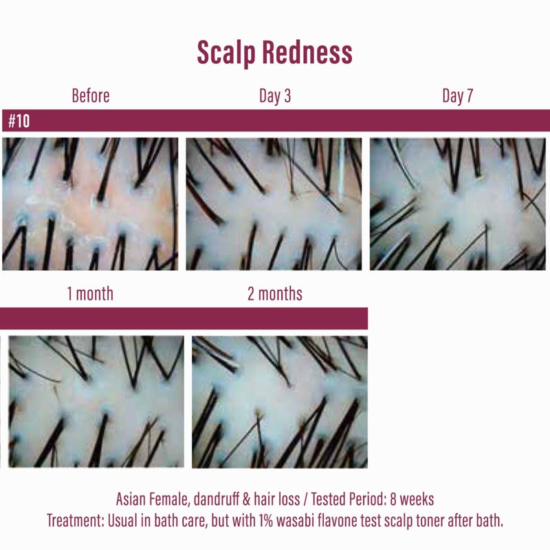 Diane مجموعة شامبو وبلسم موست ديان المضاد لتساقط الشعر للنساء والرجال، شامبو لتكثيف الشعر ضد تساقط الشعر بزيت الأركان، الكيراتين، جذور الجينسنغ، مستخلص الوسابي في اليابان 30.4 أونصة سائلة التحكم في تساقط الشعر - Image 4