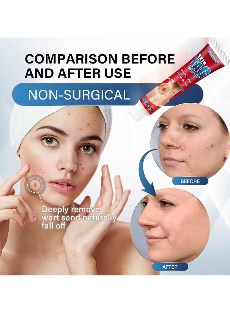 Sumifun Skin Tag for Remove Warts,Remove Moles and Smooth Skin  - Image 3