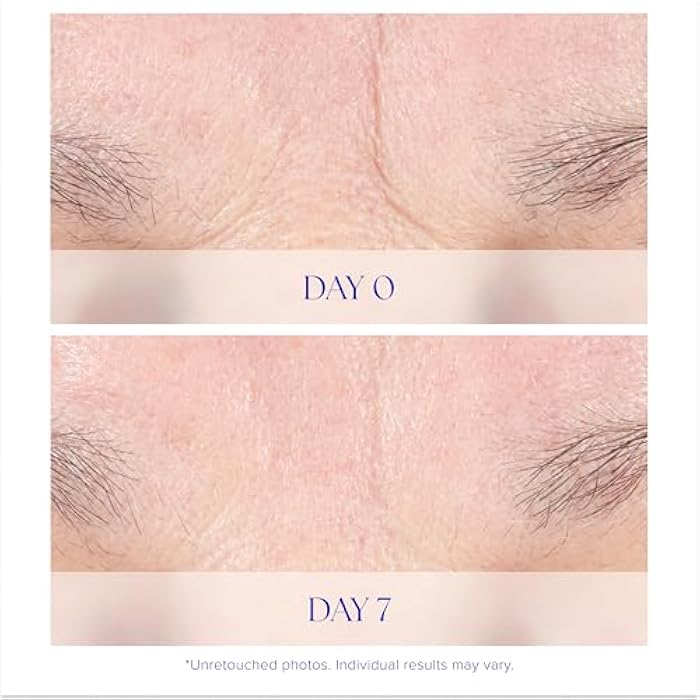 iS CLINICAL Youth Intensive Crème. Anti-aging, firming face cream. Reduces appearance of fine fines and wrinkles. - Image 4