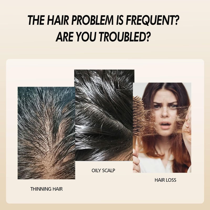 Lanthome Organic Hair Growth Spray enriched withRosemary, Onion Oil for Growth and Black Seed Oil Control Hair Loss(C, 1 Fl Oz, Unisex, Adult) - Image 3