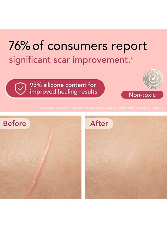 LANISKA Professional Medical Silicone Scar Tape, Collagen Scar Tape, Cuttable Waterproof Roll Tape, Hydrocolloid Patch Plasters Self-Adhesive, Waterproof Dressings, Extra Thin, Safe And Effective - For Burn, Surgical Scars, Blister, Acne Care, Sterile And Waterproof (4*150CM) - Image 3