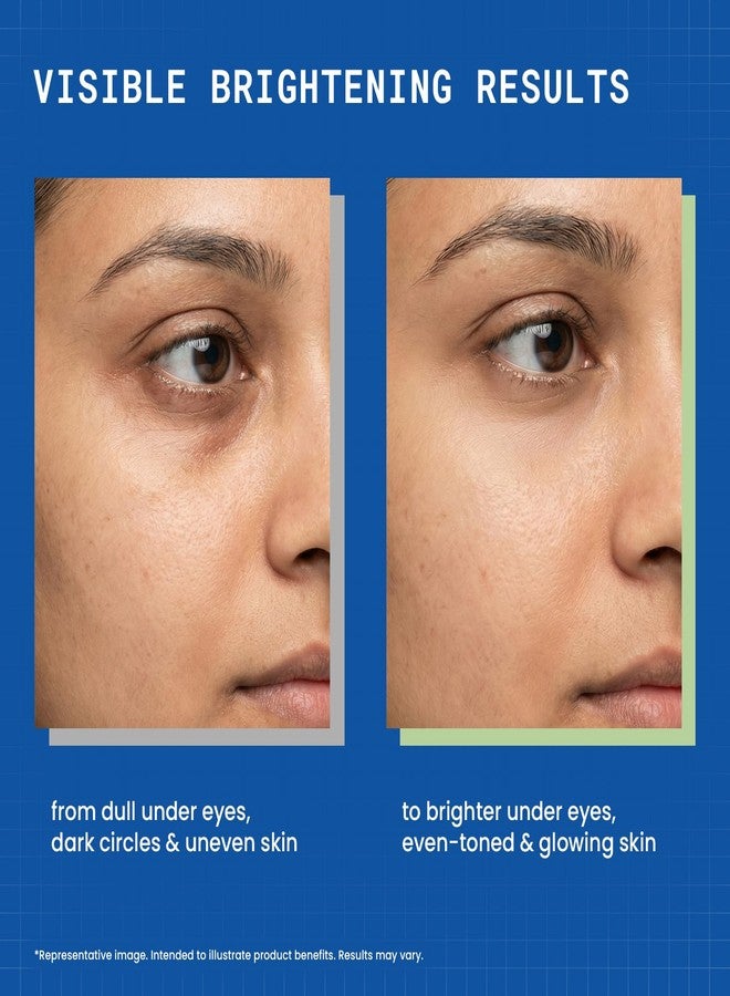 DERMDOC Morning Refresh Duo - SPF 50 Ultra Violet Purple Brightening Sunscreen with 4% Niacinamide (100g) & Niaglow 4% Niacinamide Under Eye Gel (15gm) | Tinted Sunscreen | Reduces Dark Circles & Puffiness - Image 4