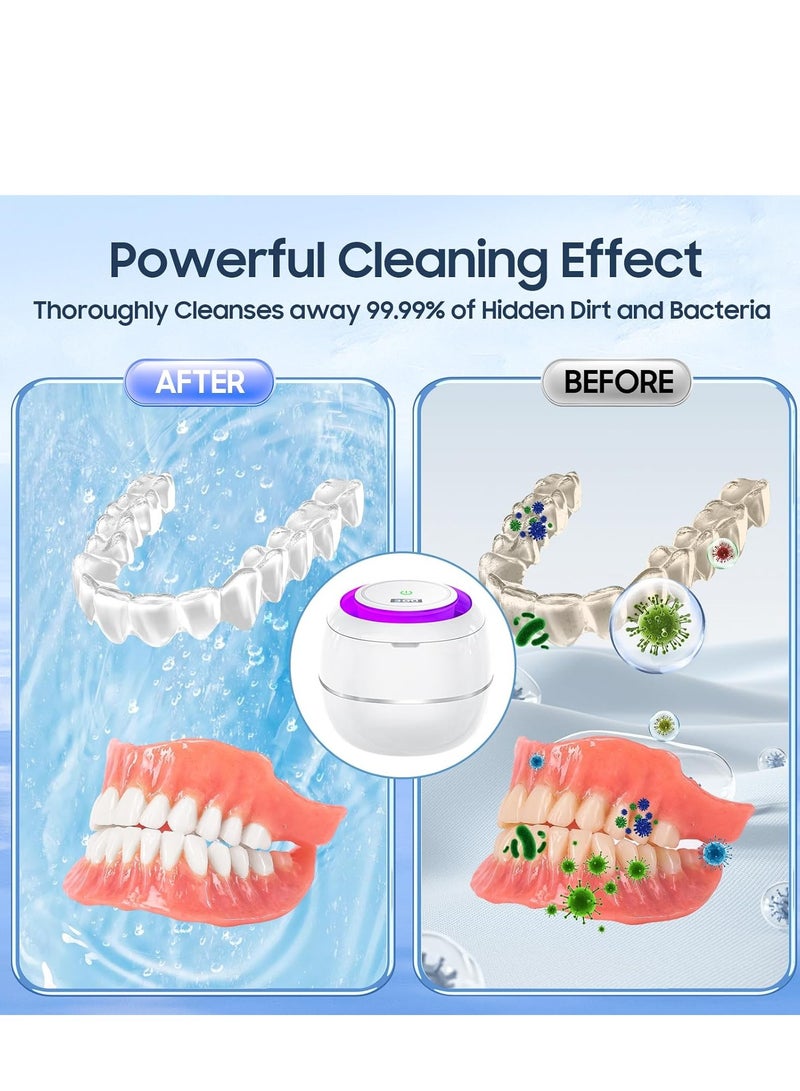 Ultrasonic Cleaner Retainer Cleaning Machine: 43kHz Ultra Sonic Cleaner Pod for Mouth Guard Denture - Professional Dental Cleaning Braces Night Guard - Image 5
