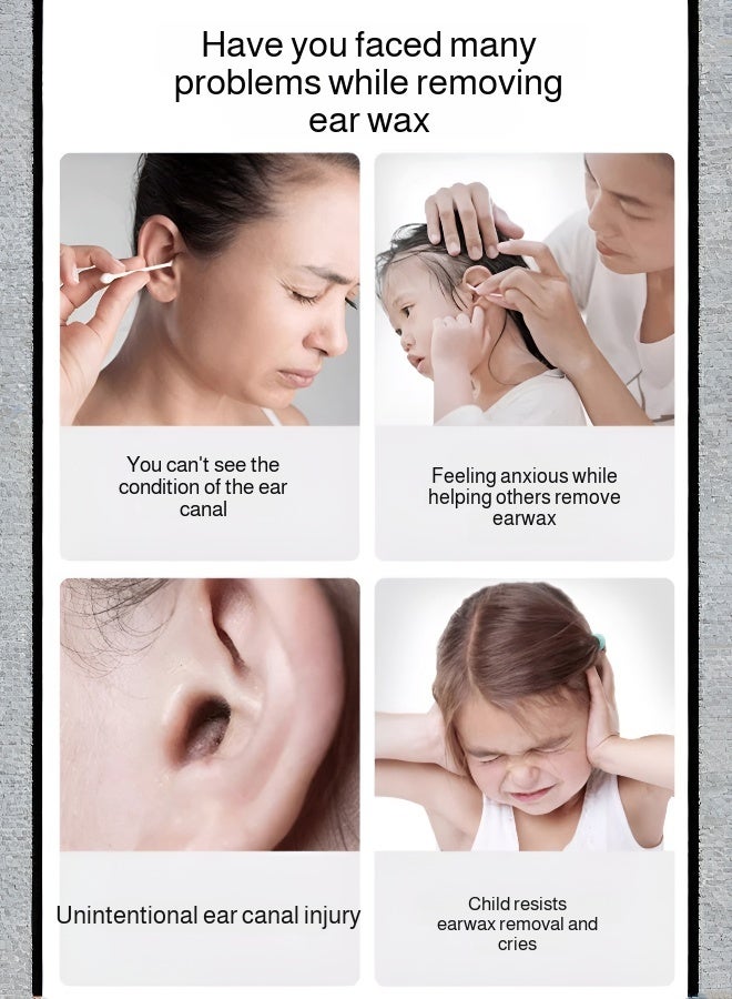 Smart Earwax Removal Tool with Lens - Image 3
